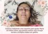 Família cria vaquinha solidária em prol de cirurgia para Maria de Fátima Alves